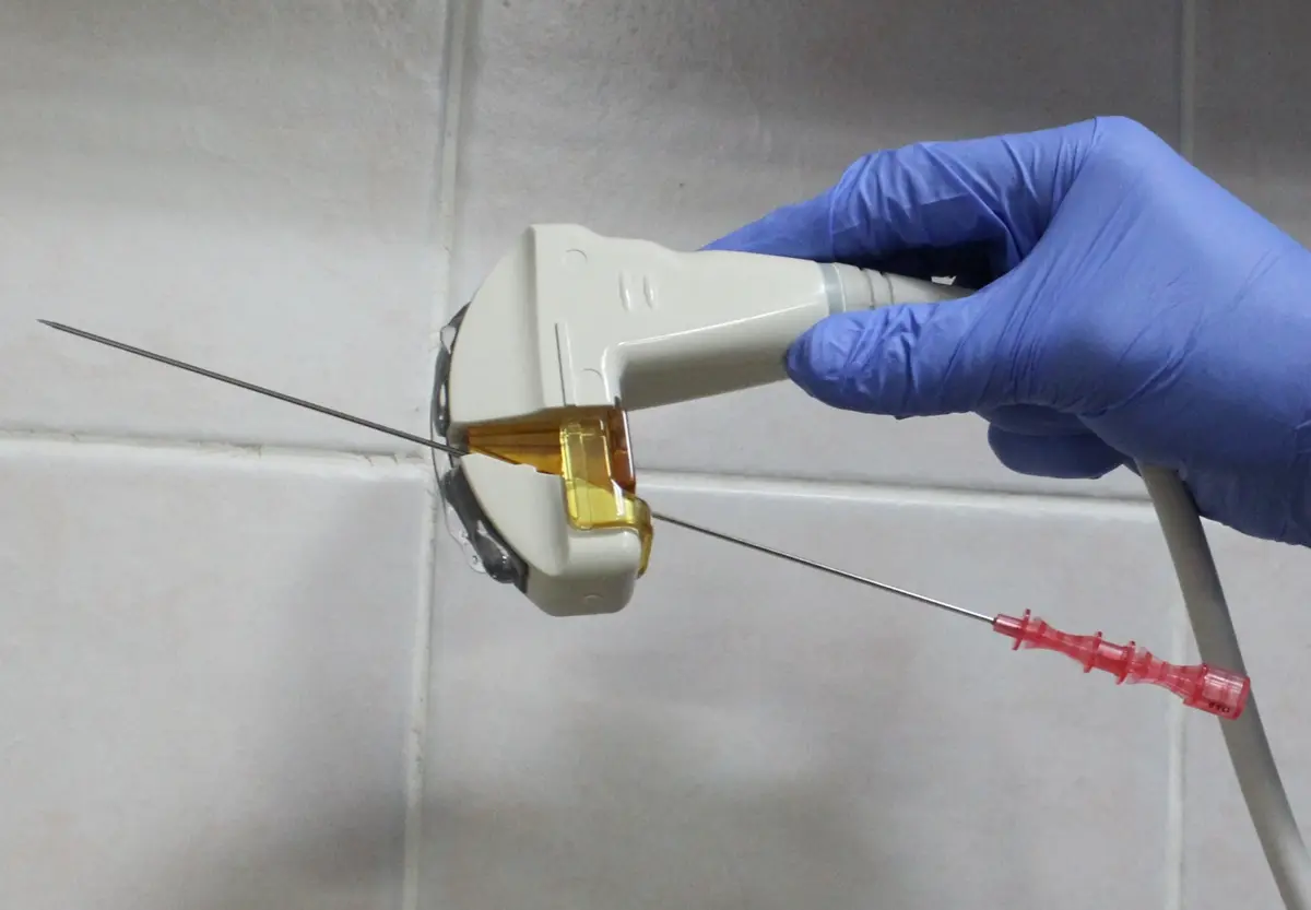 A gloved hand holding an ultrasound probe with a clip-on guide, a puncture needle passing through the guide.
