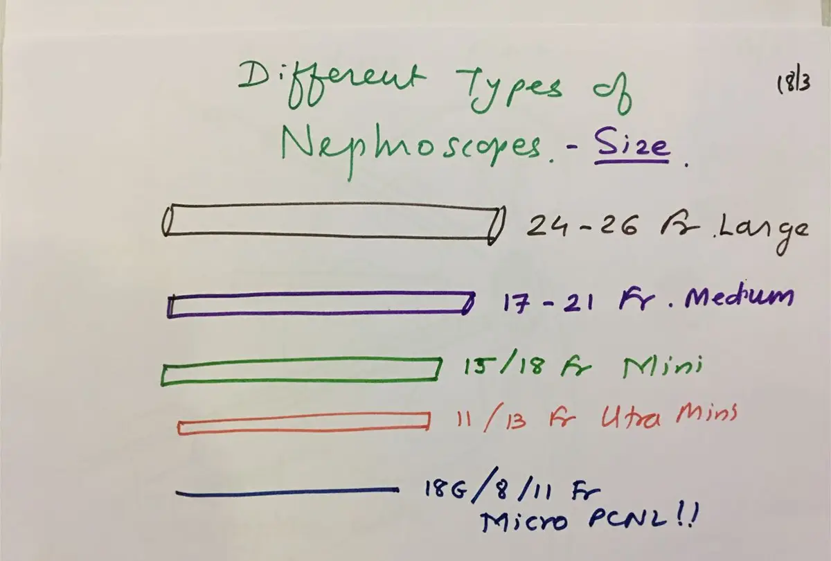 Hand-drawn chart of nephroscope sizes: large 24 to 26 Fr, medium 17 to 21 Fr, mini 15 to 18 Fr, ultra mini 11 to 13 Fr, and micro PCNL at 4.85, 8 and 11 Fr.